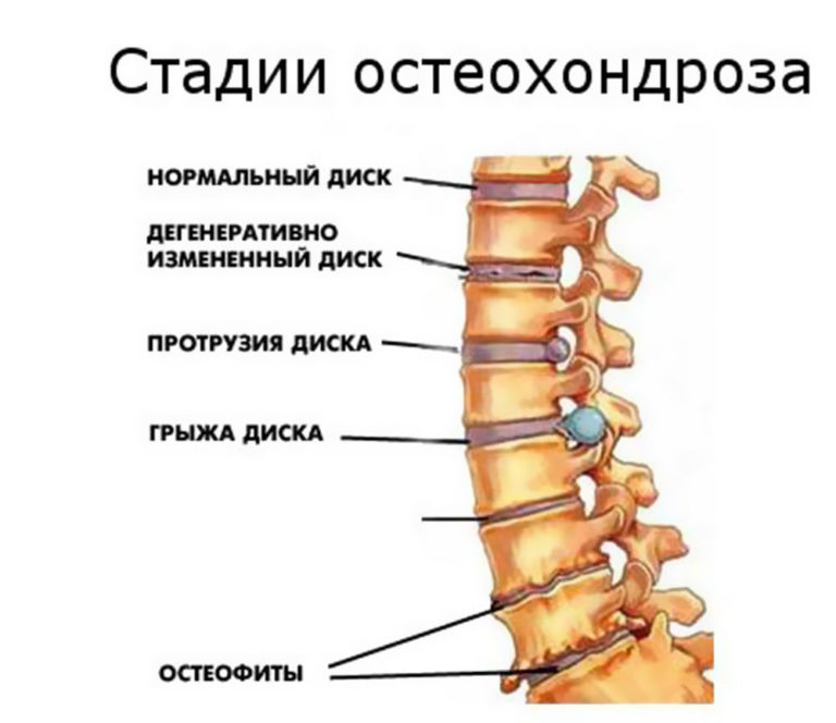 Проверить шейный отдел Проверить шейный отдел